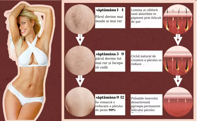Epilator cu LASER 2.0