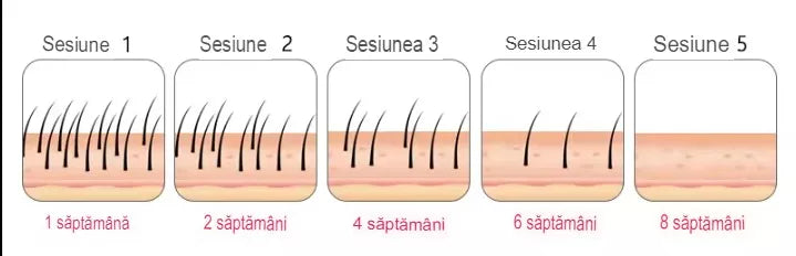 Epilator cu LASER 2.0