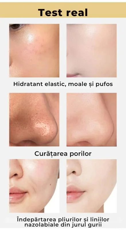 Masca Anti-Imperfectiuni cu particule de aur 24k